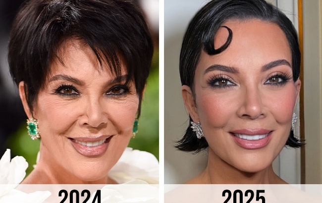 Kris Jenner’s Ageless Glow: The Facelift and Facial Secrets Behind Her Youthful Look in Summer 2025